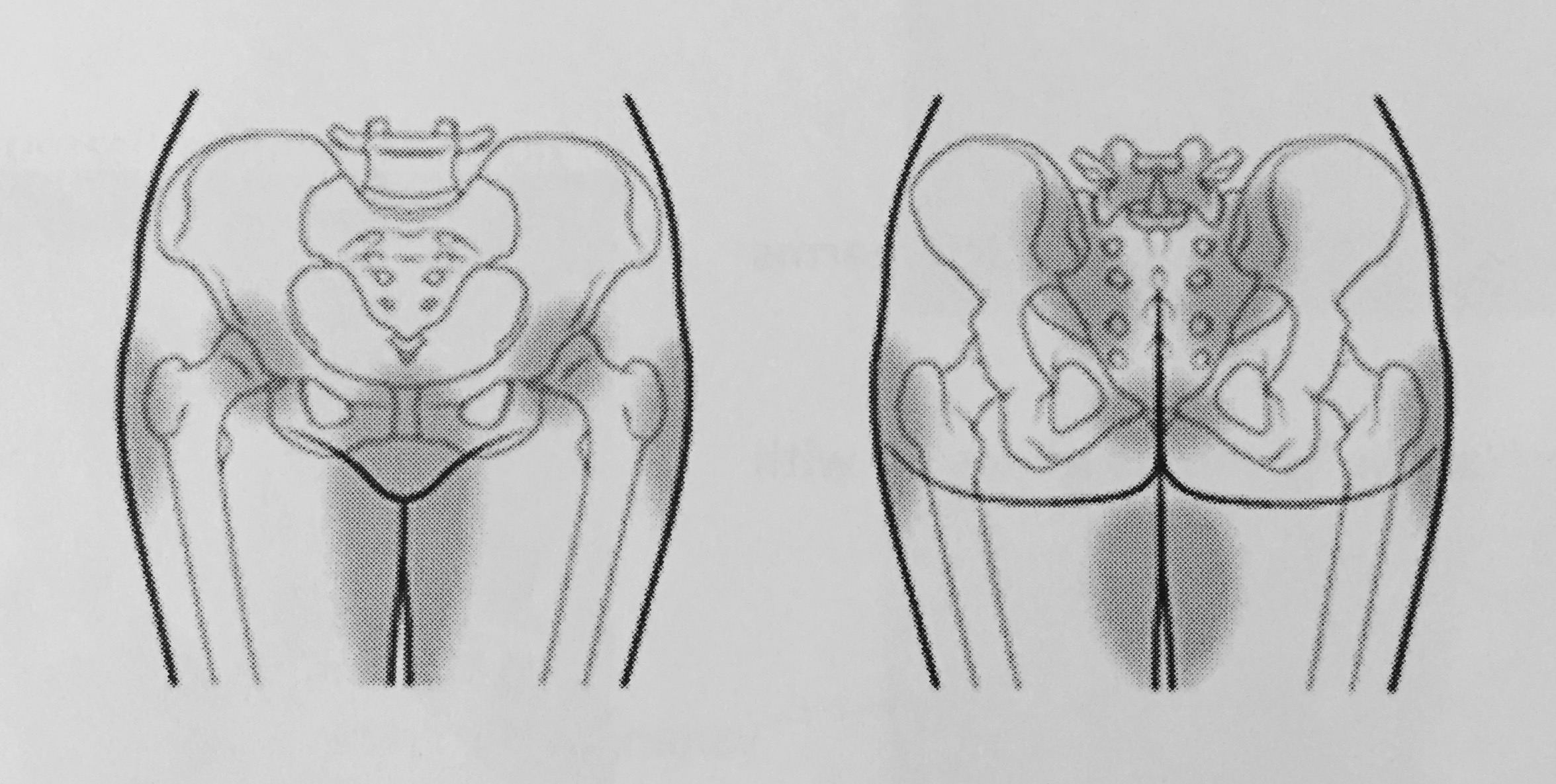 Pregnancy Pelvic Pain VivehealthVivehealth